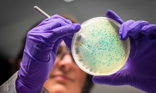 woman scientist examining e-coli bacterial culture