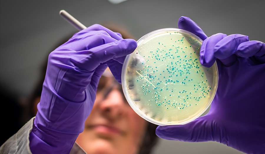 woman scientist examining e-coli bacterial culture